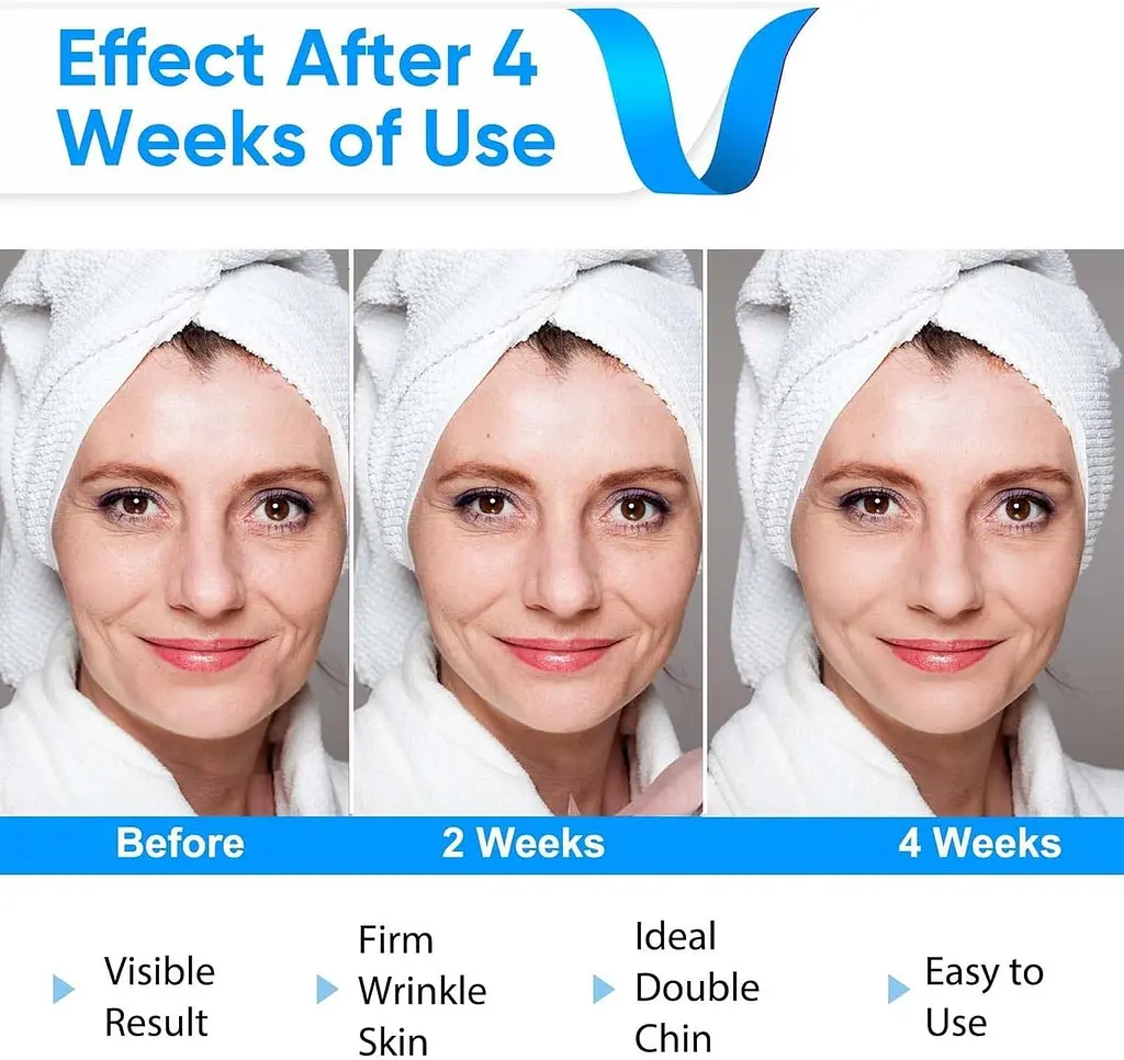 Електричний масажер V-Face FaceLift для обличчя з блакитним світлом - фото 2