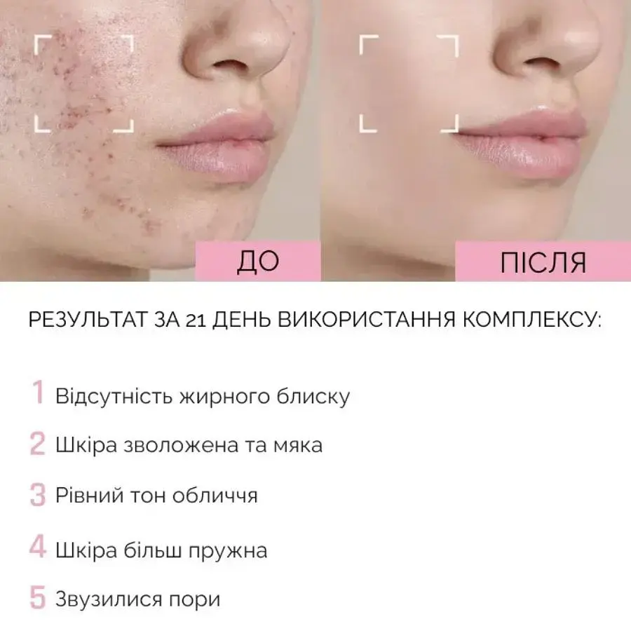 Зволожуючий тонік для обличчя з ніацинамідом Reclaire cosmetics 100 мл - фото 4
