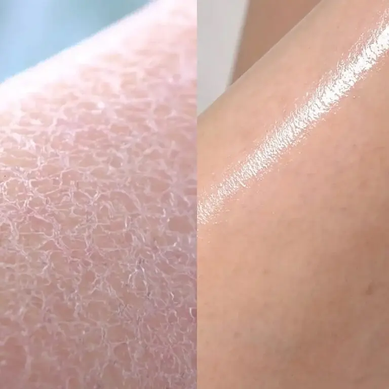 Протизапальний гель для душу з кислотами Red Acne Body Wash 2.0 Medicube 400 г - фото 2