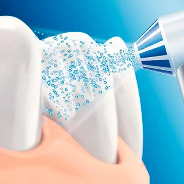 Іригатор Oral-B MD20 OxyJet [67759] - фото 9