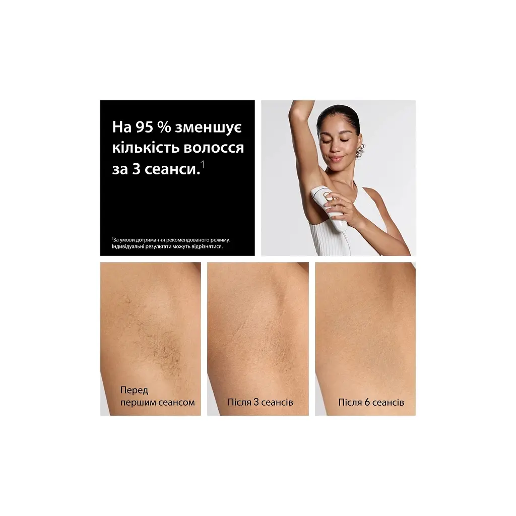 Фотоепілятор Braun PL5351 + GIL Venus - фото 3