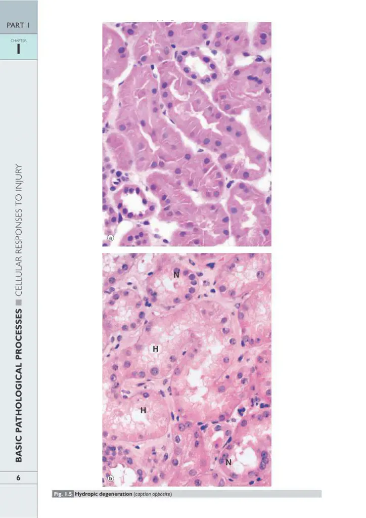 Wheater's Basic Pathology: A Text, Atlas, and Review of Histopathology. International Edition, 5th Edition - Вільям Стюарт - фото 9