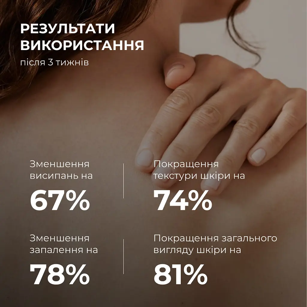 Сироватка для проблемної шкіри з саліциловою кислотою Back & Body Acne Control serum Hillary 50 мл - фото 8