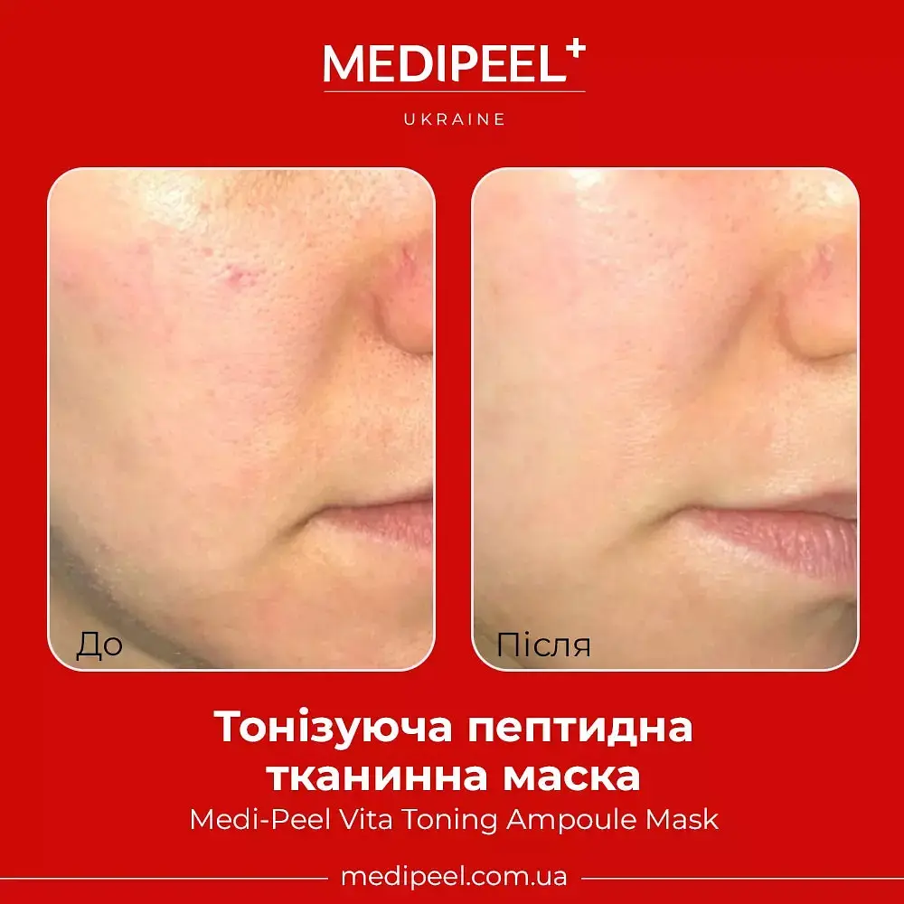 Тканевая маска для лица Medi-Peel Vita Toning Ampoule Mask тонизирующая ампульная 30 мл - фото 3