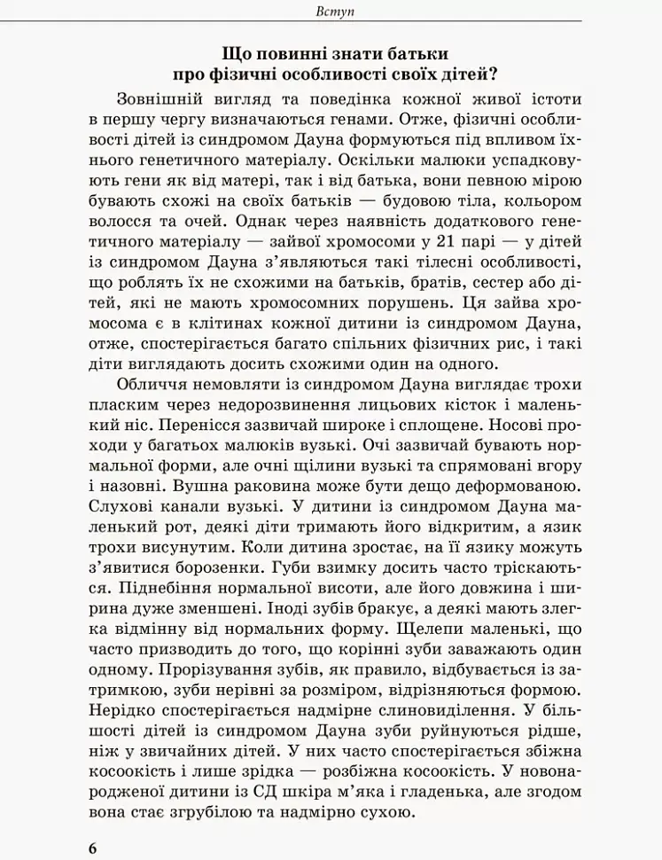 Дитина із синдромом Дауна - Анна Чеботарьова - фото 2