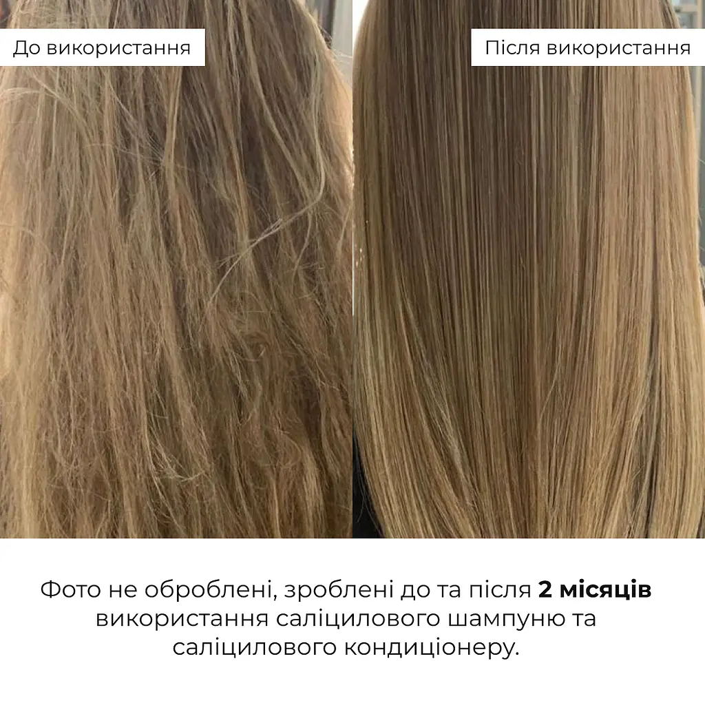 Саліциловий кондиціонер для відновлення волосся Salicylic Hair Reset Conditioner Hillary 400 мл - фото 4