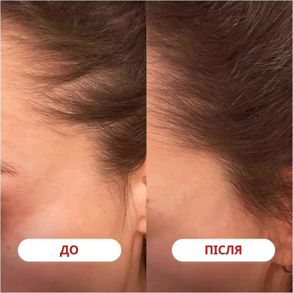 Дієтична добавка Perla Helsa A-Biotin Біотин + Амінокислоти 30 капсул - фото 9