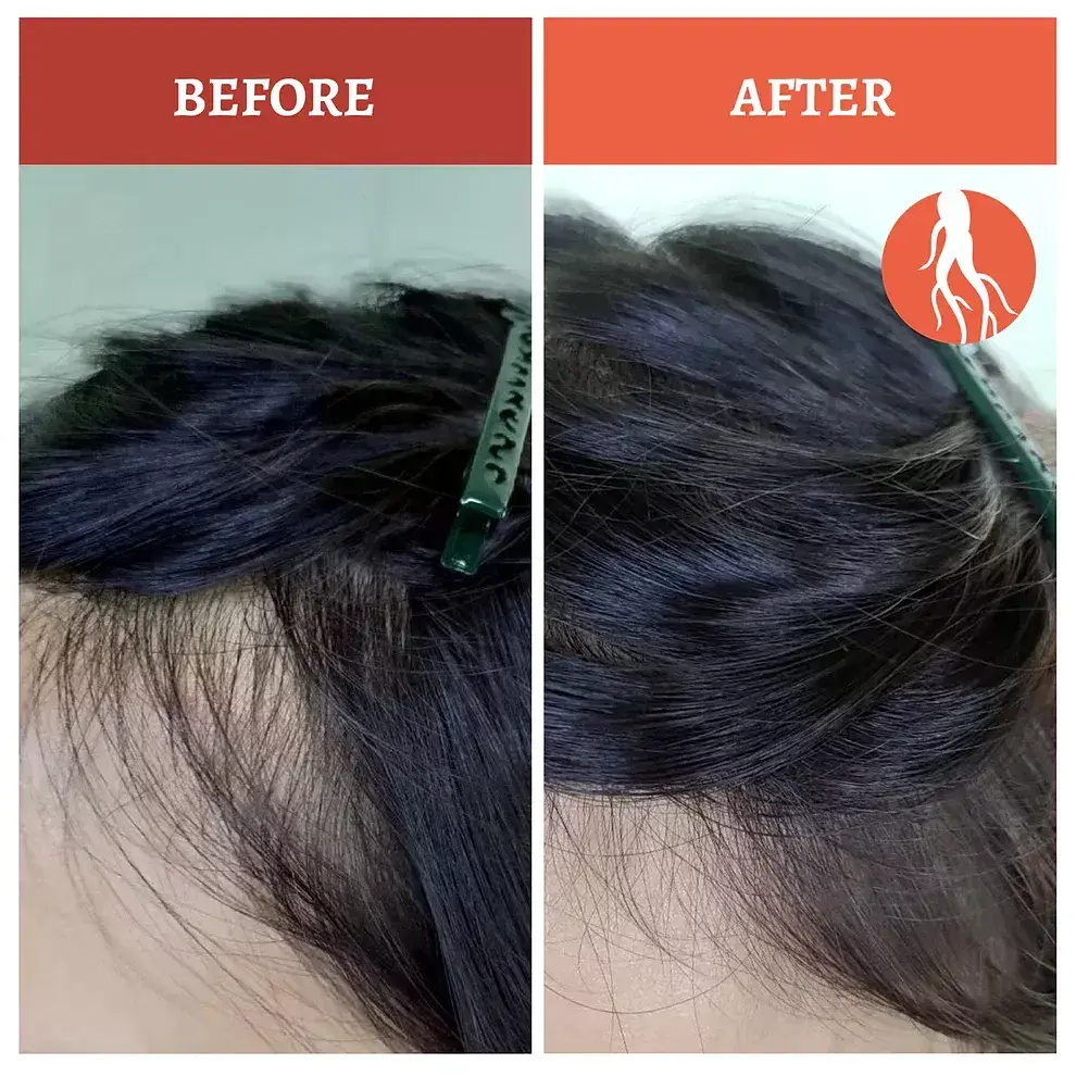 SH-RD Red-Ginseng Hair-Activating Shampoo професійний шампунь проти випадіння на основі червоного женьшеню, 200 мл - фото 8