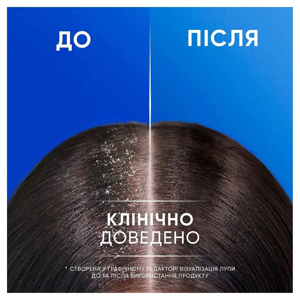 Шампунь проти лупи Head & Shoulders Свіжа м'ята 2-в-1, 400 мл  - фото 4