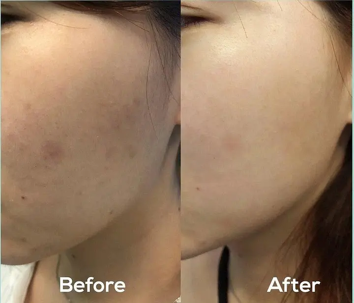 Сыворотка для лица AXIS-Y Dark Spot Correcting Glow Serum Sample, 1.5ml - фото 4