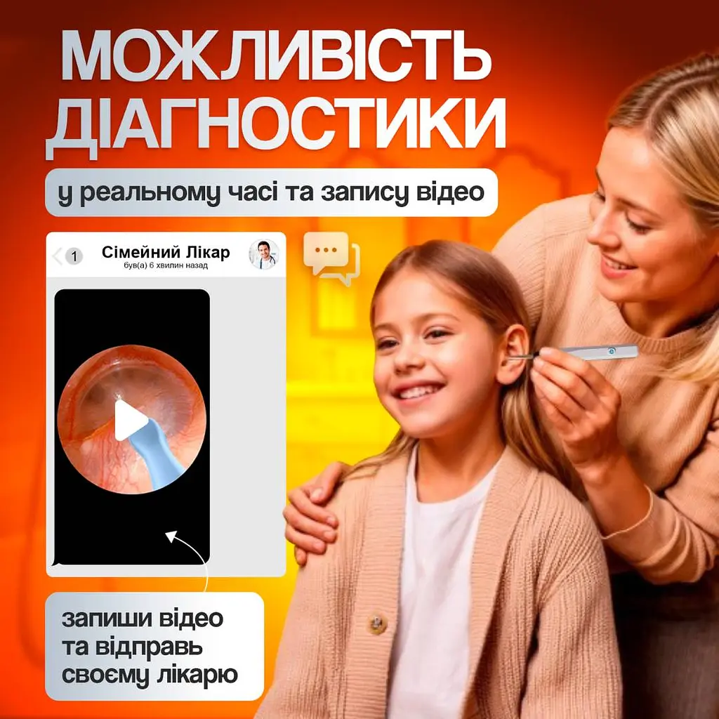Пристрій для видалення вушної сірки з камерою Brillix 1296P Білий (PO-White) - фото 3