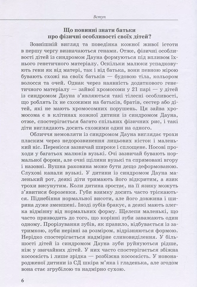Дитина із синдромом Дауна - фото 5