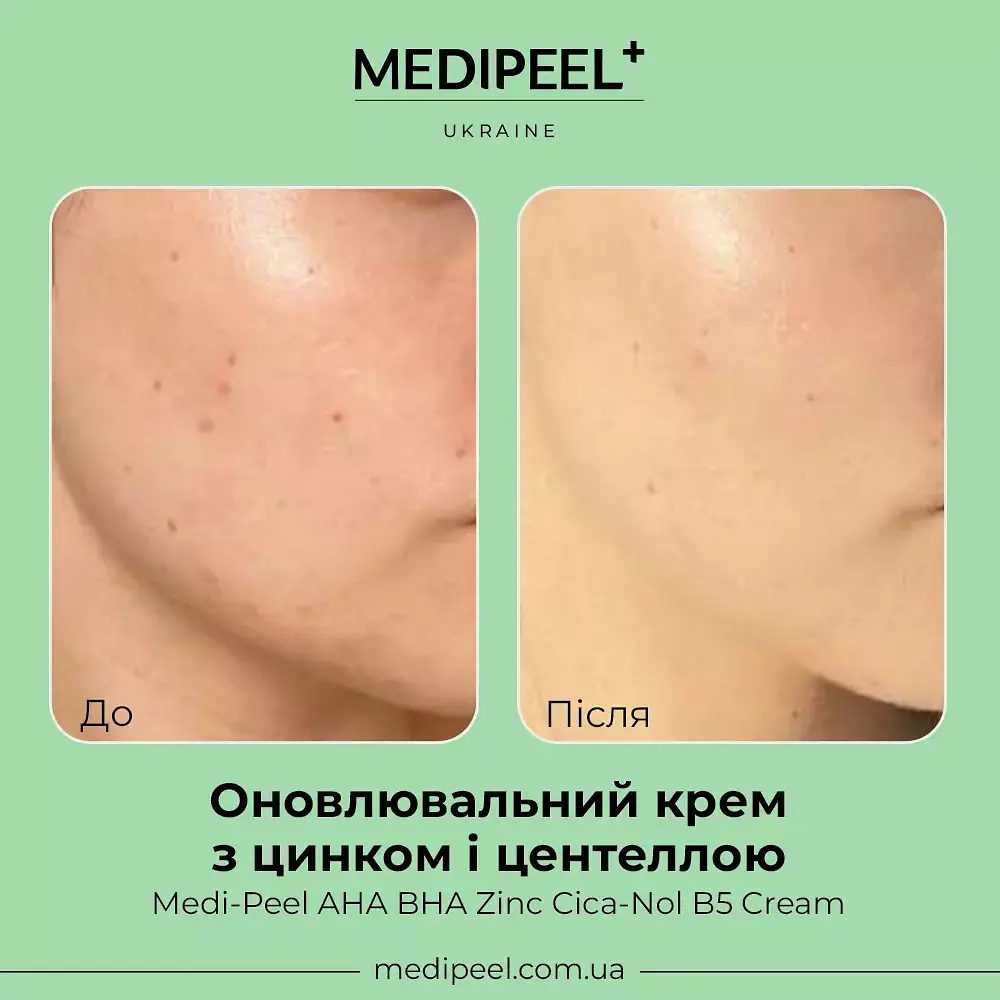Крем для обличчя Medi Peel AHA BHA Zinc Cica-Nol B5 Cream оновлювальний з цинком і центеллою 30 мл - фото 2