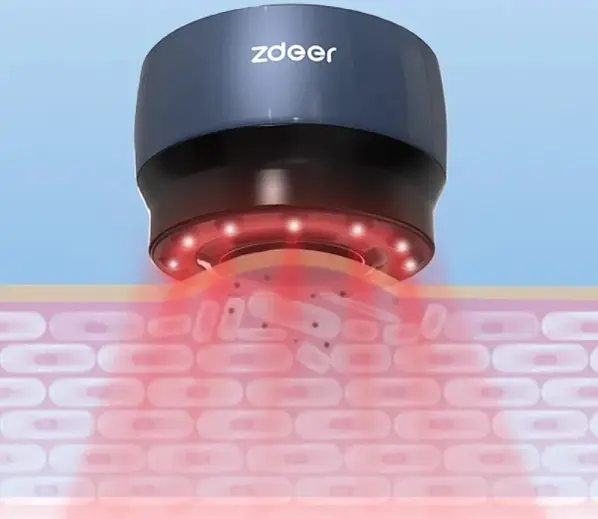 Вакуумна масажна банка Zdeer Антицелюлітна банка 2000mah 100 хв. роботи + 9 режимів - фото 2