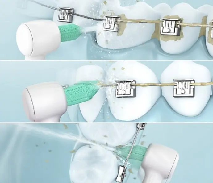 Іригатор Panasonic EW1313G DentaCare [69900] - фото 4