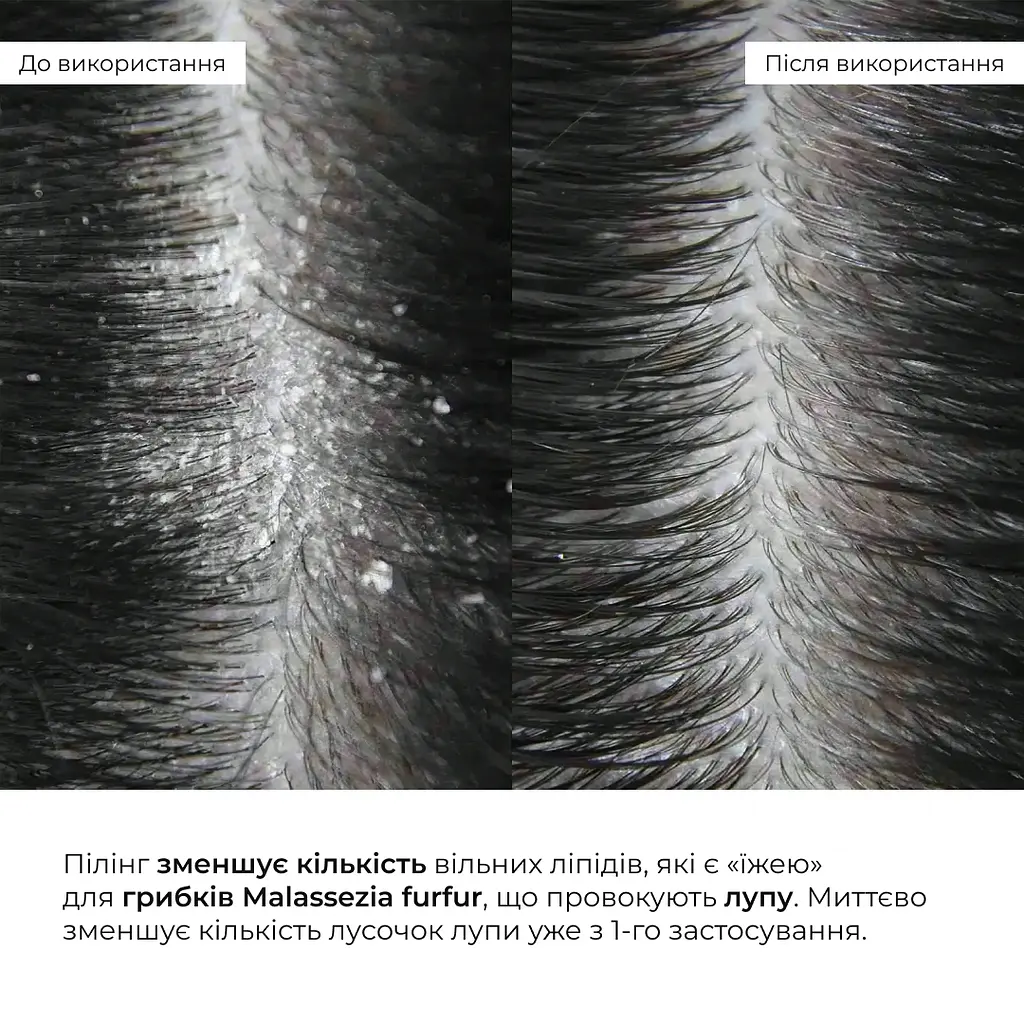 Комплекс для сухих и поврежденных волос Perfect Care Hair Aloe Hillary - фото 19