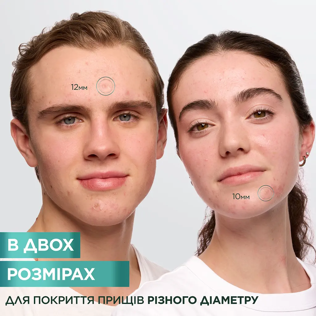 Гідроколоїдні патчі проти прищів Garnier Пюр Актив 22 шт. - фото 4