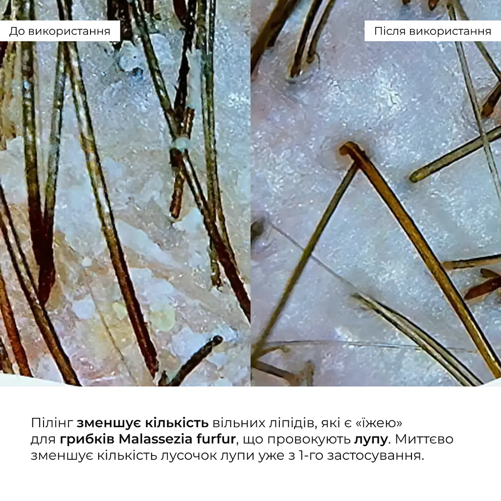 Комплекс для всех типов волос Perfect Care Hair Nori Hillary - фото 22