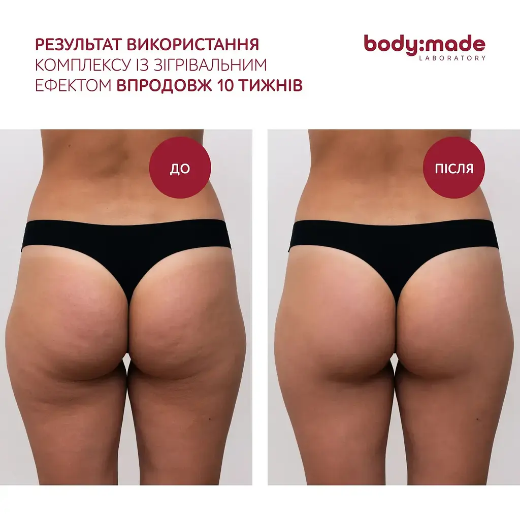 Бандажне обгортання з антицелюлітним ефектом зігрівальне BodyMade 150 мл х 2 бинти - фото 6