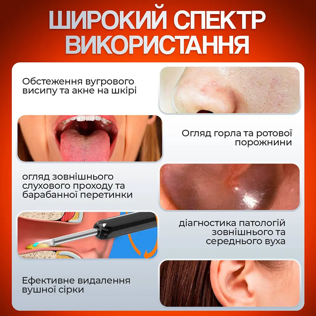 Пристрій для видалення вушної сірки з камерою Brillix 1296P Чорний (PO-Black) - фото 4