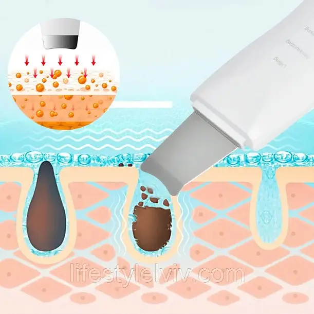 Ультразвуковий скрабер для очищення обличчя Skin Tech Scrubber 3305 Білий (3305O) - фото 5