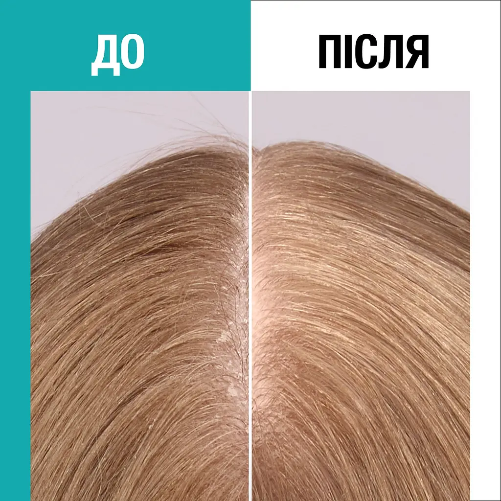 Шампунь Gliss Scalp Balance 200 мл - фото 9