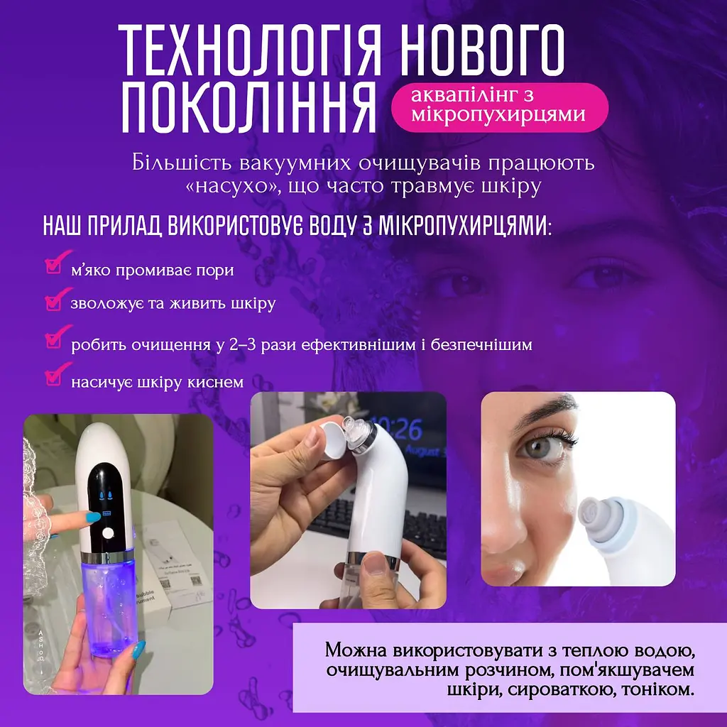Вакуумний очищувач пор No Brand 0.8 Вт Білий (WVC-067) - фото 6