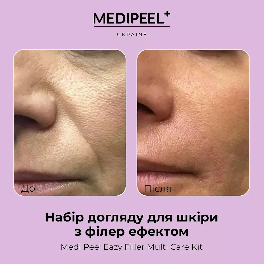 Ліфтинг-набір з ефектом філера MediPeel Eazy Filler Multi Care Kit 4 засоби - фото 6