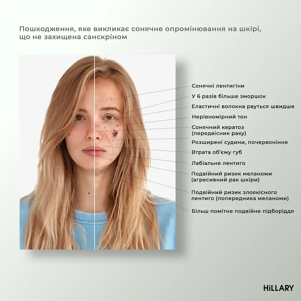 Набір Hillary для домашньої мезотерапії з біо-ретинолом Регенерація та живлення - фото 11