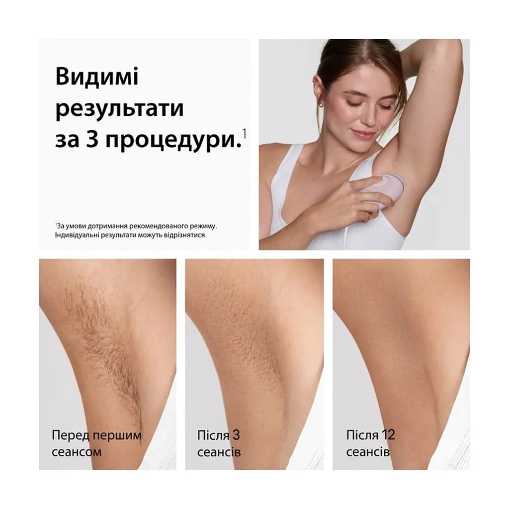 Фотоепілятор Braun PL1111 + GIL Venus - фото 3