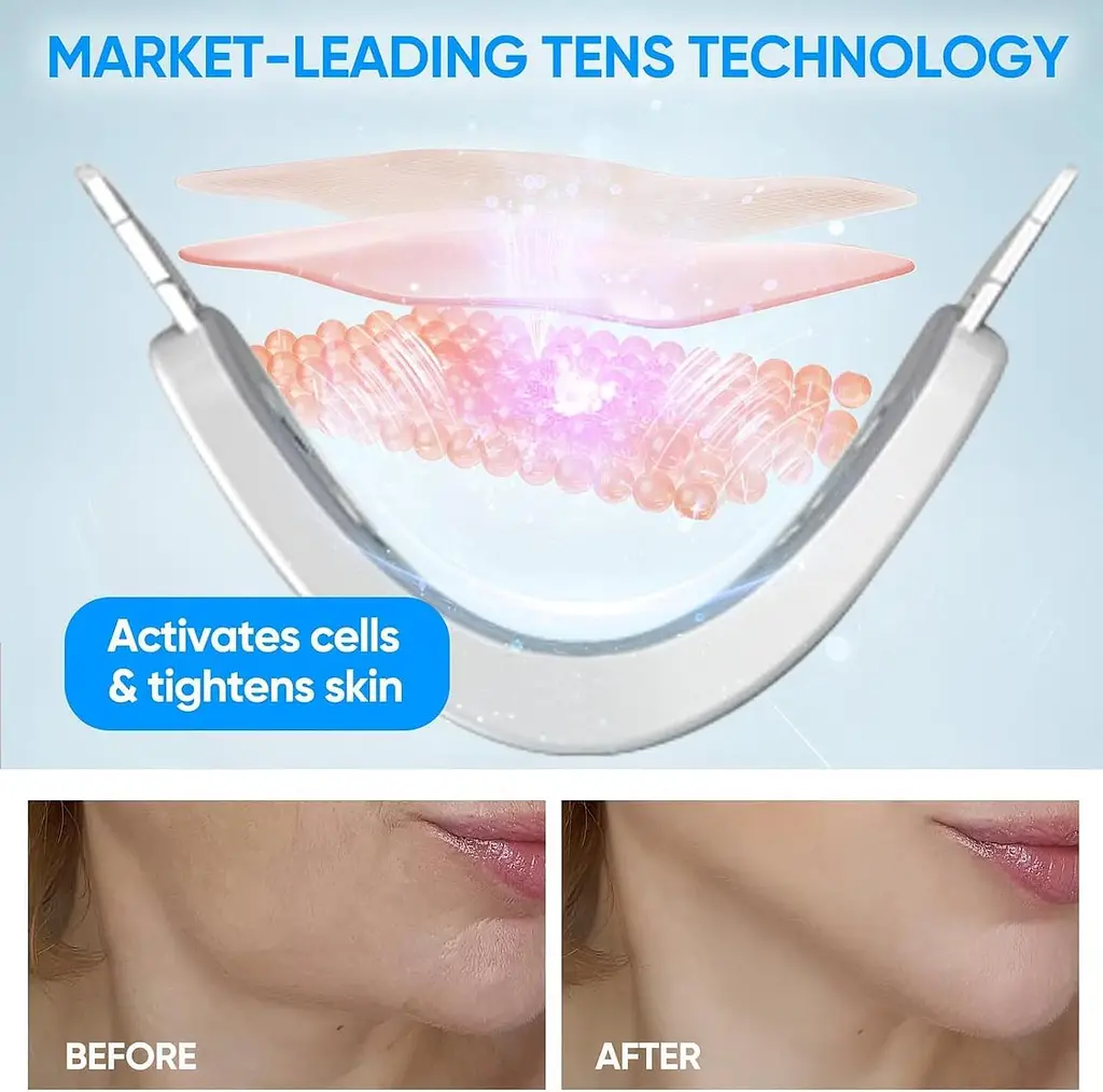 Електричний масажер V-Face FaceLift для обличчя з блакитним світлом - фото 7