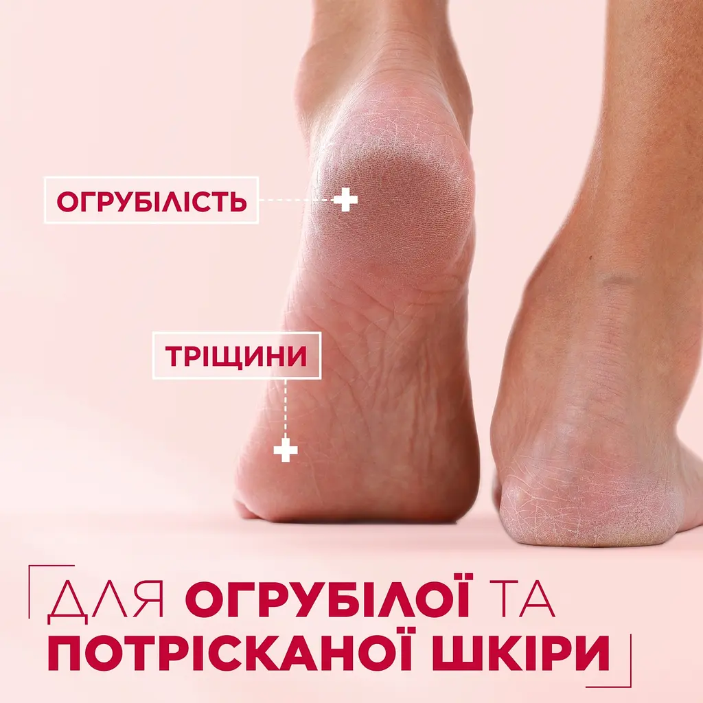 Багатофункціональний відновлювальний крем щільної текстури Mixa 10-In-1 Cica Repair+ Repairing Ointment для потрісканої, огрубілої чутливої шкіри тіла 150 мл - фото 11