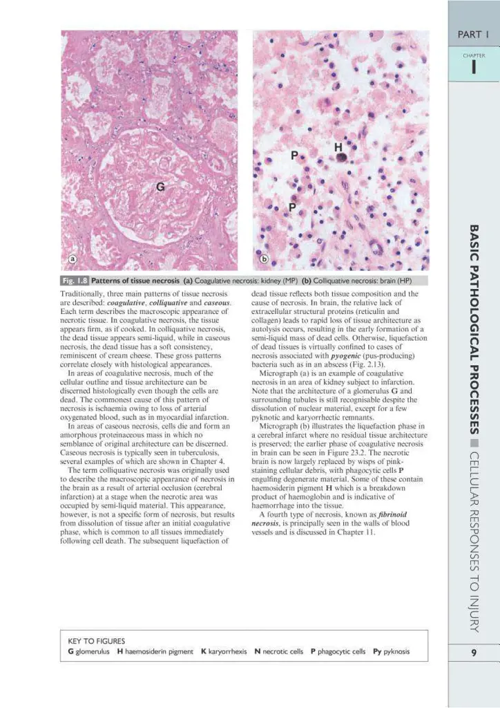 Wheater's Basic Pathology: A Text, Atlas, and Review of Histopathology. International Edition, 5th Edition - Вільям Стюарт - фото 12