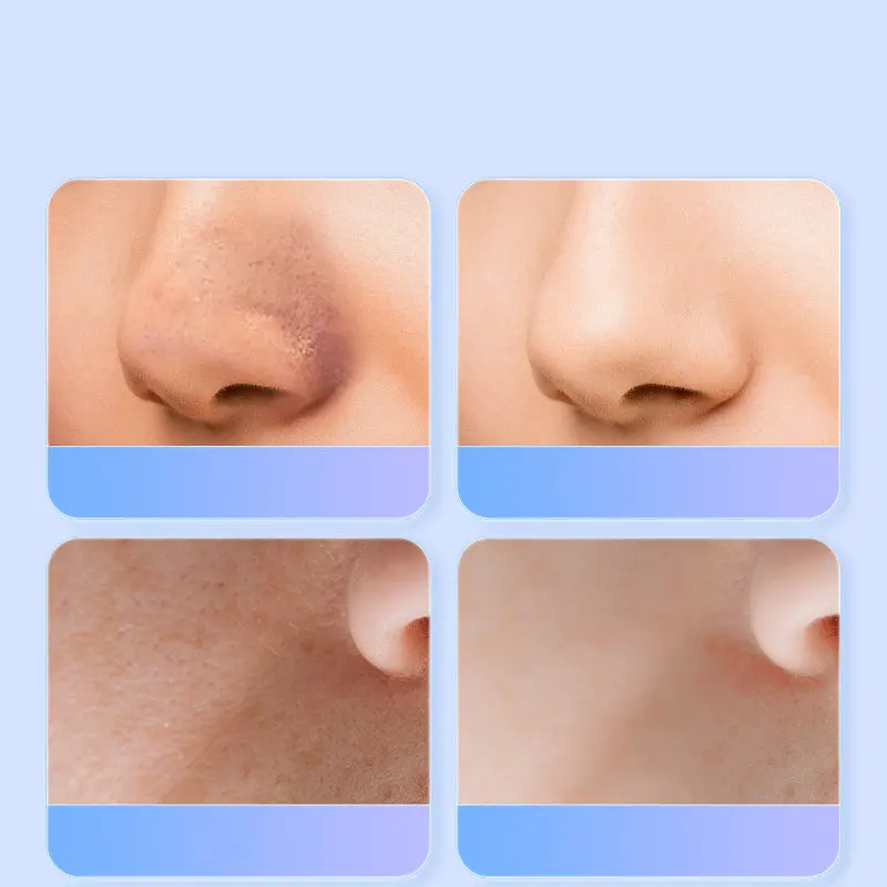Ультразвуковий скрабер для очищення обличчя Skin Tech Scrubber 3305 Білий (3305O) - фото 4