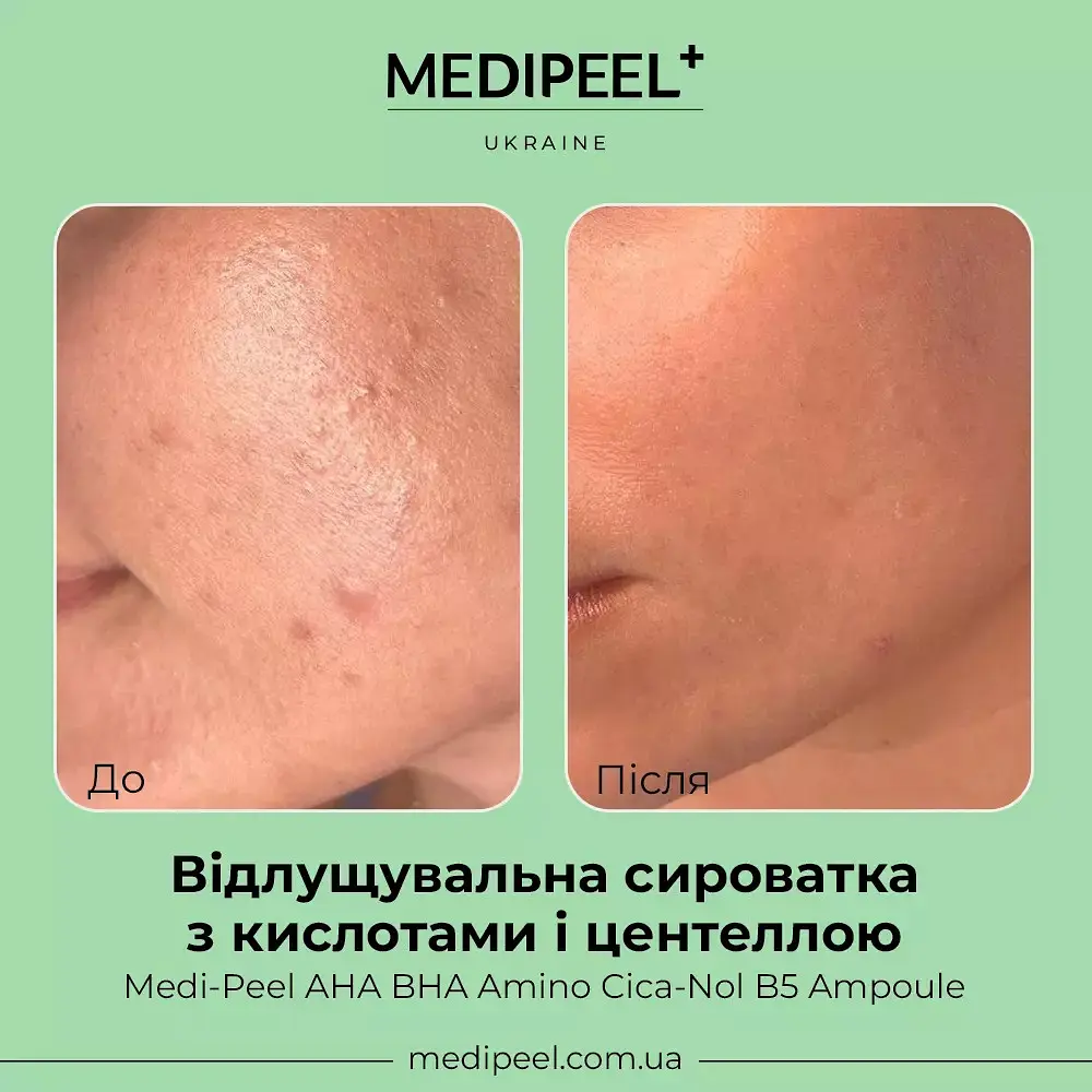 Сироватка для обличчя Medi-Peel AHA BHA Amino Cica-Nol B5 Ampoule відлущувальна 30 мл - фото 4