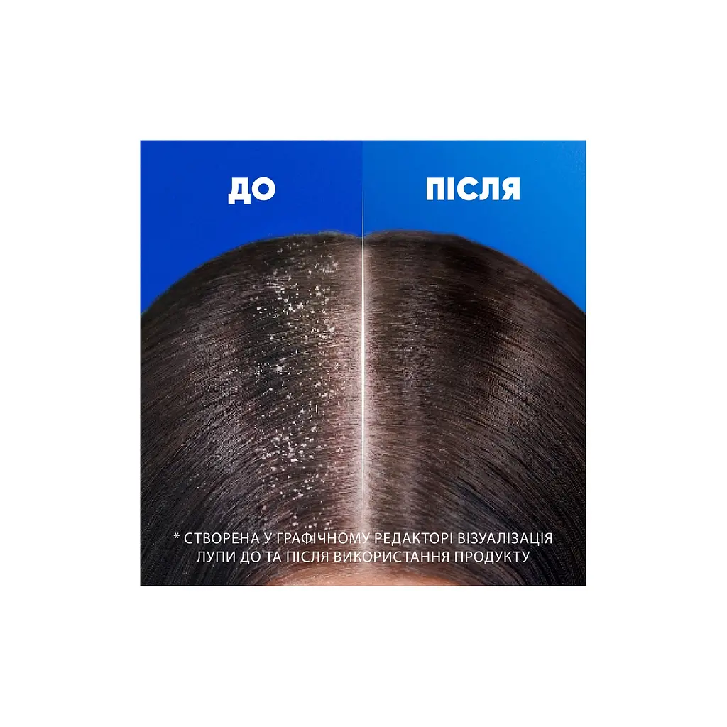 Шампунь Head & Shoulders Для чутливої шкіри 400 мл (5011321336124) - фото 5