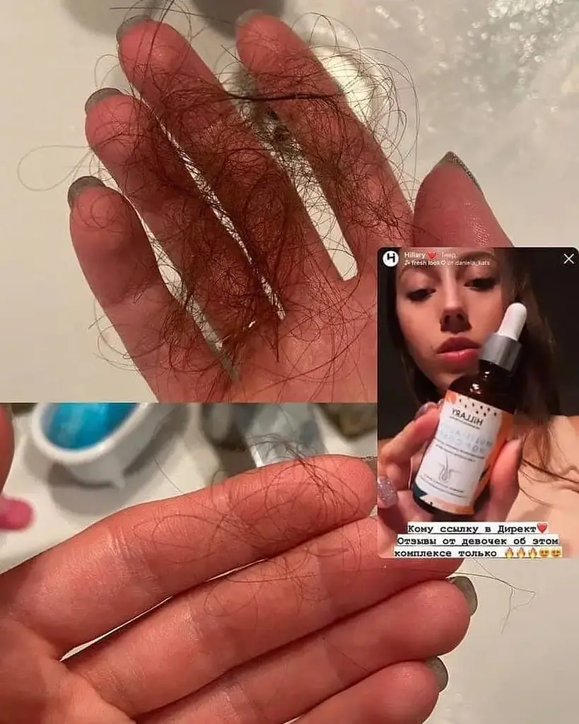 Мультиактивный комплекс Hillary Multi-Active Hop Cones с экстрактом шишек хмеля 50 мл - фото 5