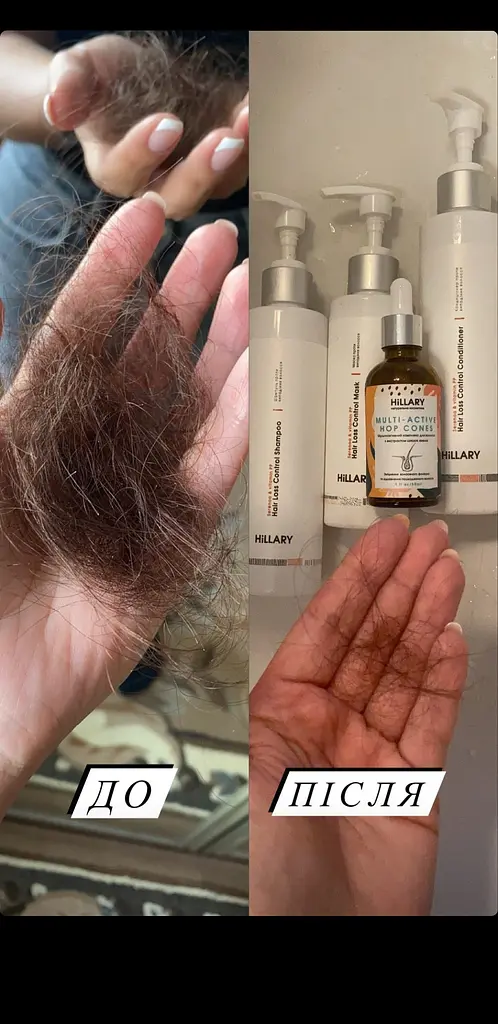 Набір проти випадіння волосся + Мезороллер для шкіри голови Hillary - фото 14