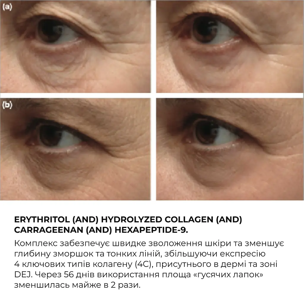 Крем для комплексного омоложения кожи вокруг глаз ReNuAge Time Warp Eye Cream Hillary 15 мл - фото 10