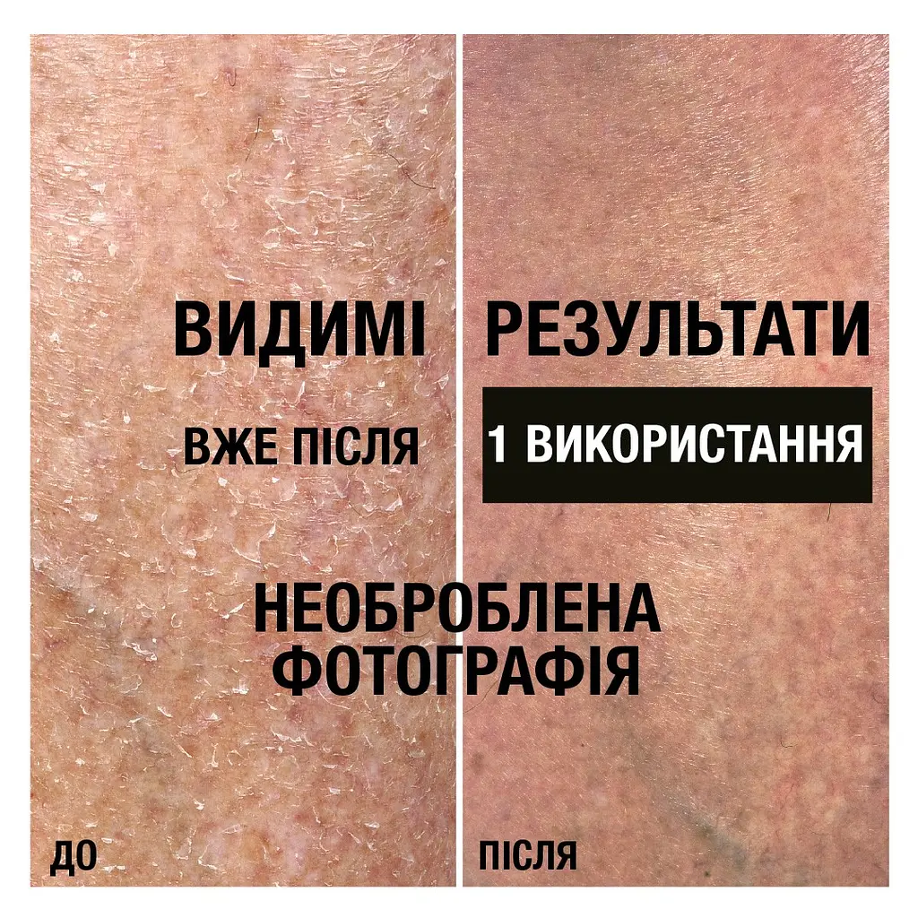 Лосьйон для тіла Neutrogena Інтенсивне відновлення 250 мл - фото 6