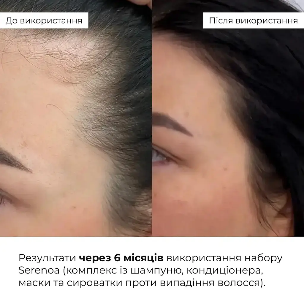 Шампунь Hillary Serenoa & РР Hair Loss Control проти випадіння волосся 250 мл - фото 12