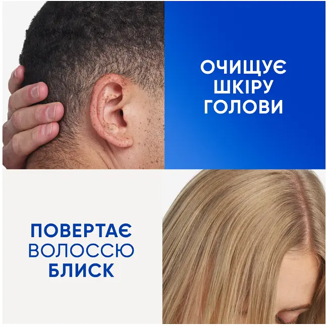 Шампунь проти лупи Head & Shoulders Очищення та блиск 400 мл - фото 5
