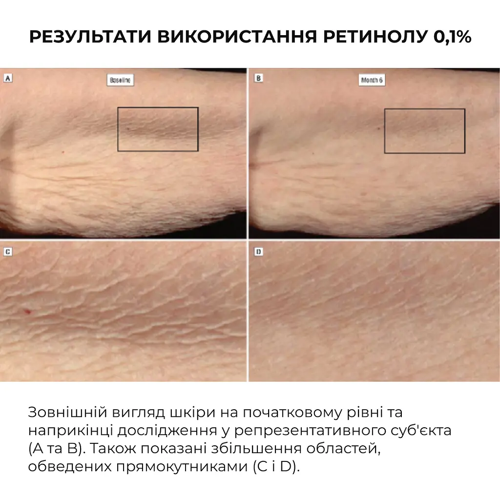 Сироватка для активного відновлення шкіри ReNuAge Retinol Active Renewal Serum Hillary 30 мл - фото 12