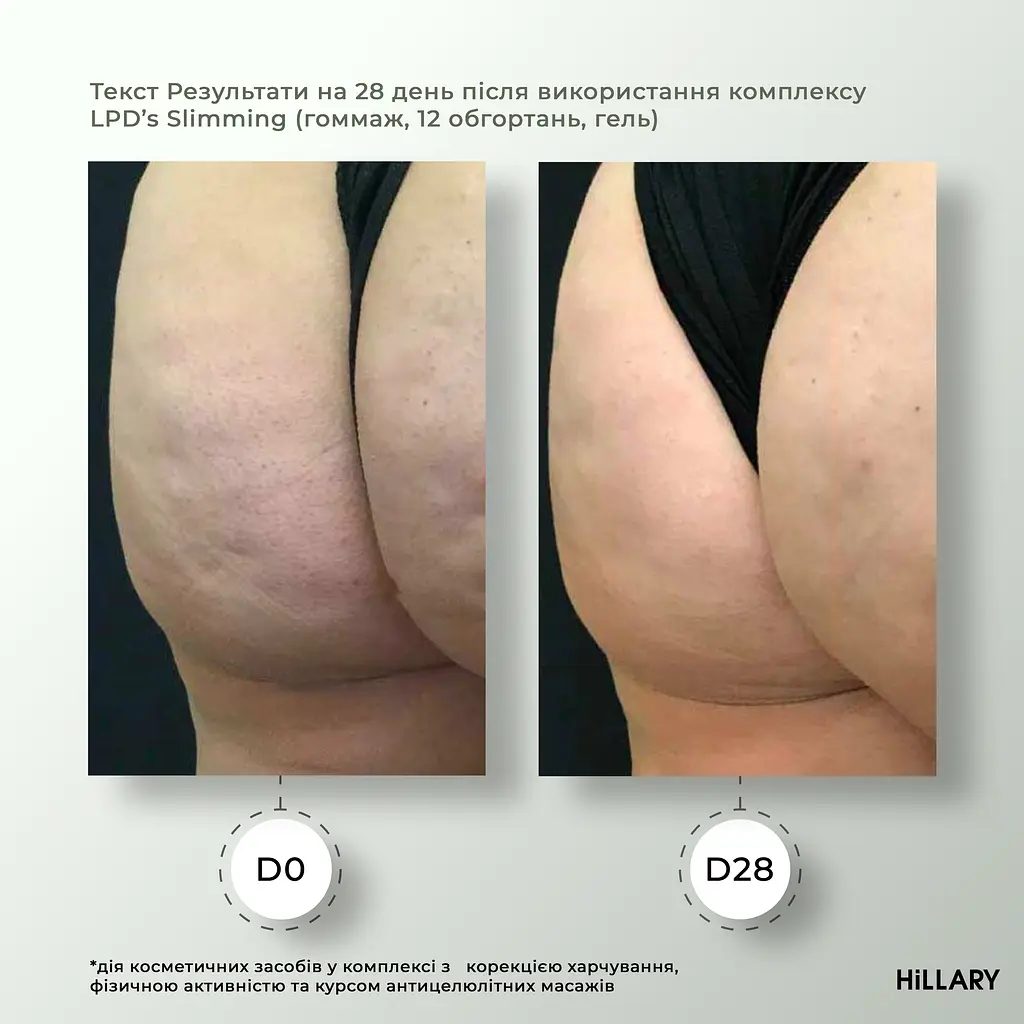 Набор Антицеллюлитные липосомальные обертывания + жидкость Anti-cellulite LPD'S Slimming (12 процедур) Hillary - фото 9