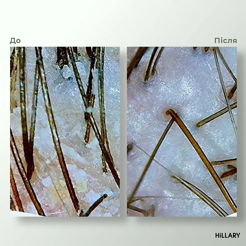 Энзимный пилинг для кожи головы + Набор для жирного типа волос Green Tea Phyto-essential Hillary - фото 12