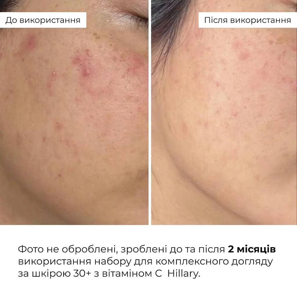 Набір Hillary для комплексного догляду за шкірою 30 + з вітаміном С а С 30 + - фото 2