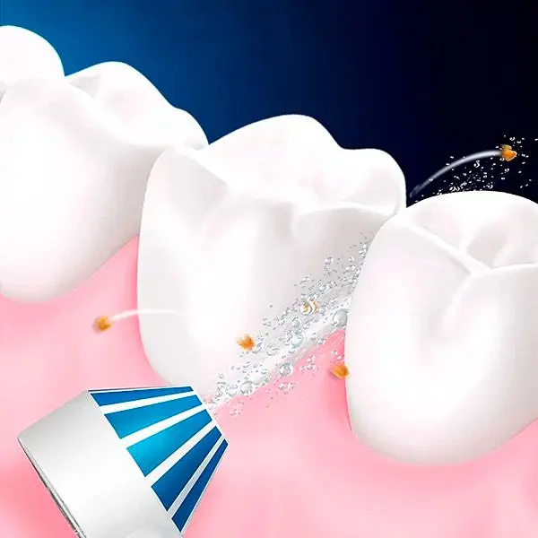 Іригатор Oral-B MD20 OxyJet [67759] - фото 8