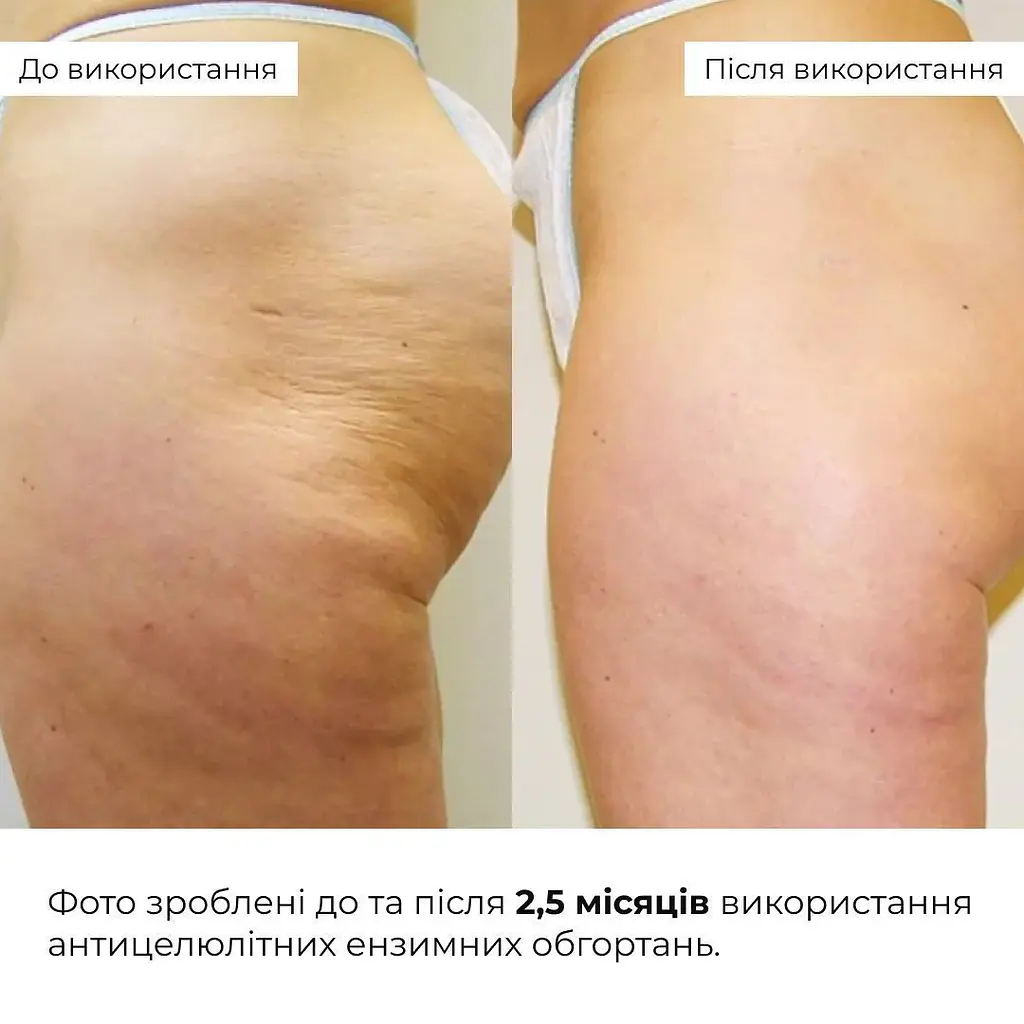 Набор антицеллюлитных разогревающих обертываний Hillary Heating Anti-Cellulite Wrap Set - фото 9