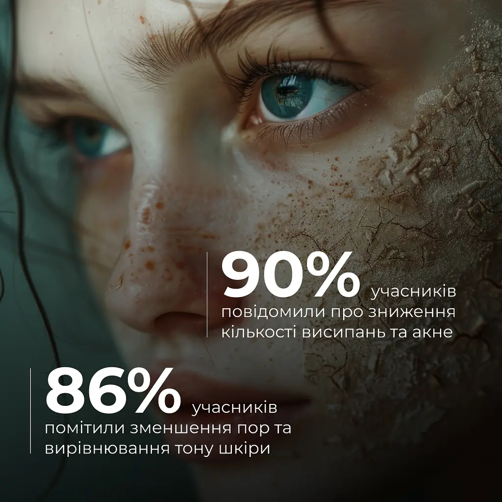 Глиняная детокс-маска для проблемной кожи лица Anti-Acne & Detox Clay Mask Hillary 90 мл - фото 5