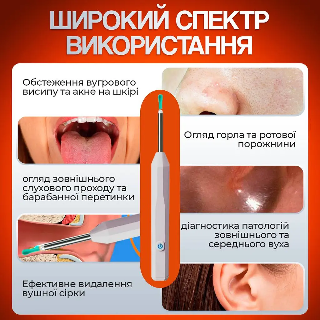 Пристрій для видалення вушної сірки з камерою Brillix 1296P Білий (PO-White) - фото 4